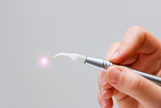 Soft tissue laser dentistry hand tool