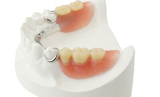 closeup of partial dentures