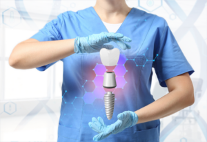 a virtual model of dental implants