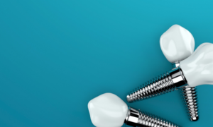 a close-up of dental implant posts 